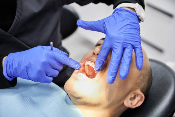 Best Emergency Wisdom Tooth Extraction in Birch Bay, WA